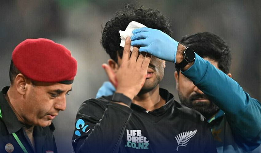 نیوزی لینڈ کے راچن رویندرا پریکٹس کے دوران چہرے پر چوٹ لگنے سے زخمی