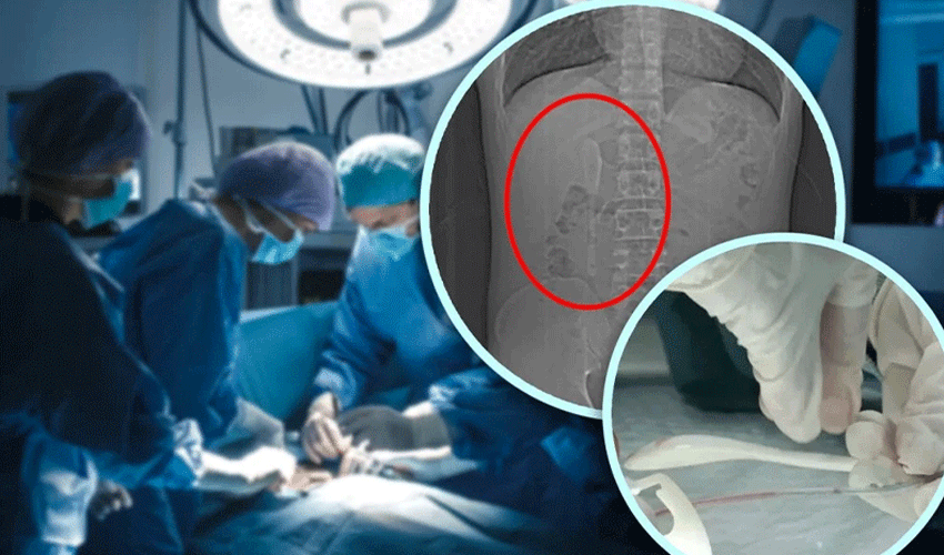 کراچی کے ڈاکٹرز کا شاندار کارنامہ، مریضہ کے پیٹ سے بغیر سرجری تالہ نکال لیا